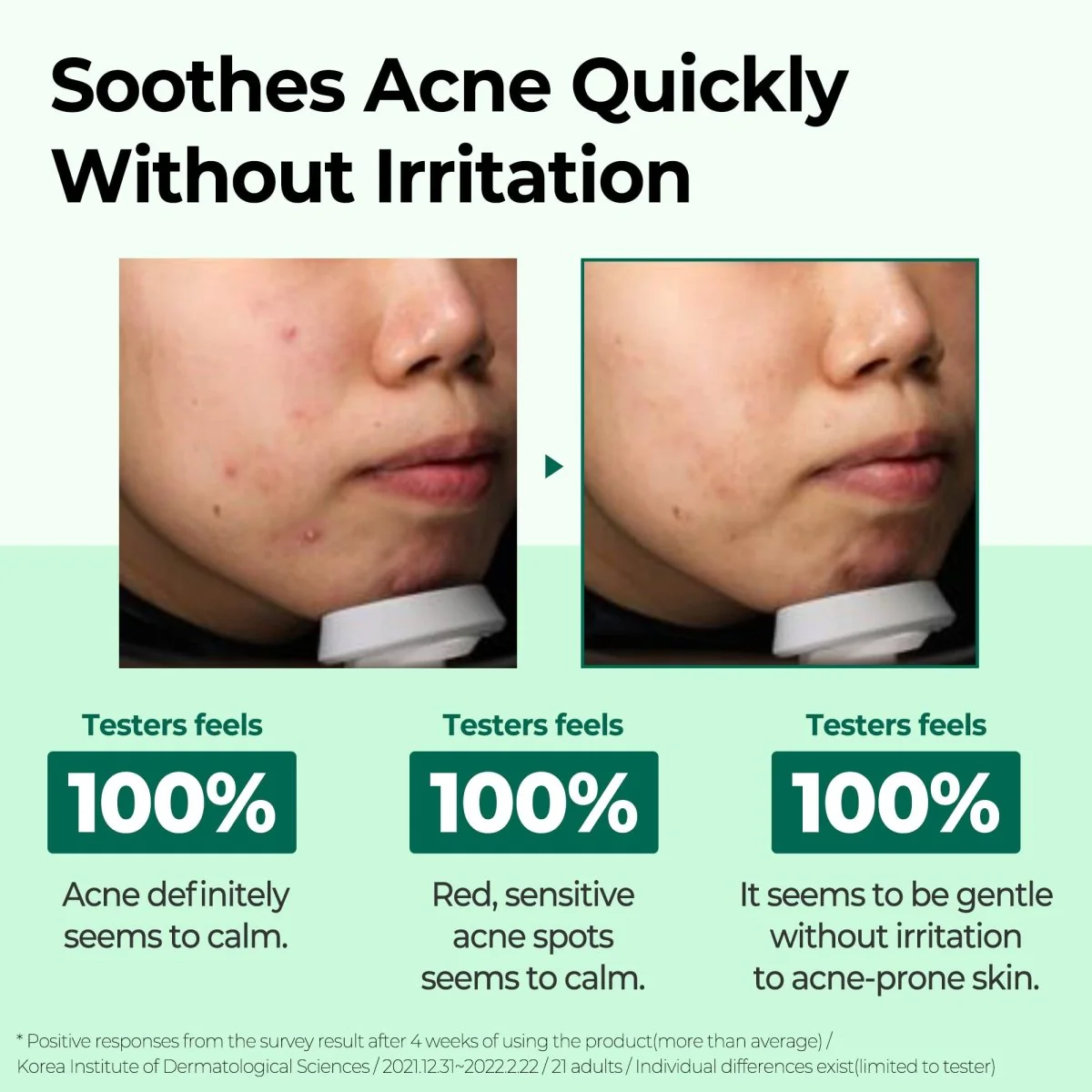 Acne-Prone Skin Ultimate Skincare Routine - Image 2