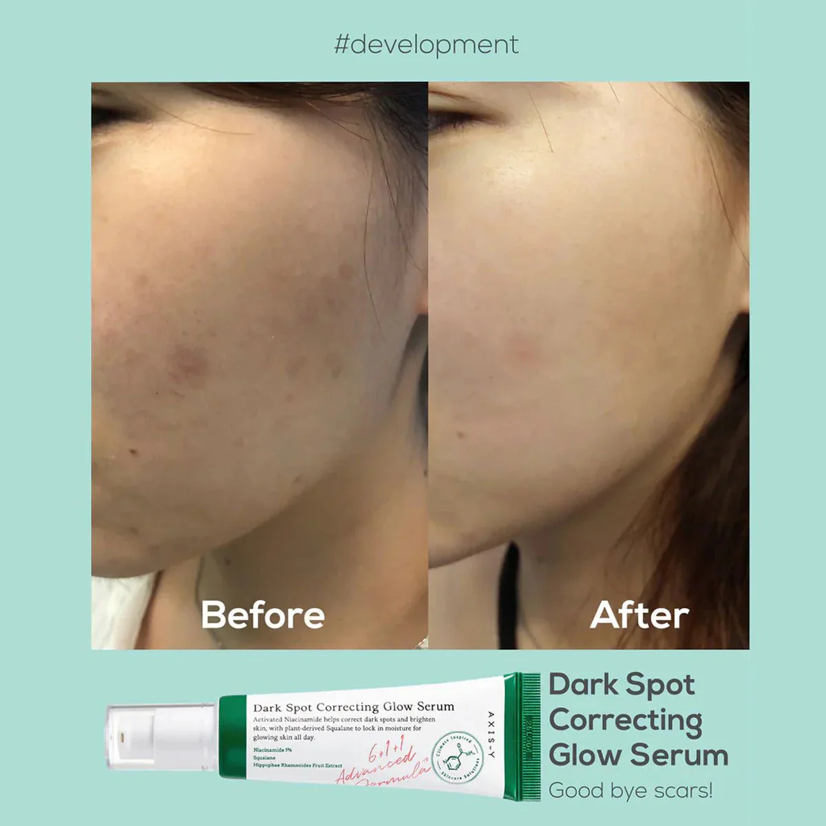 Axis-y Dark Spot Glow Serum 50ml - Image 7