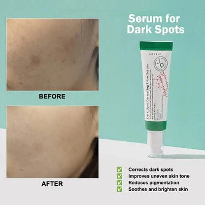 AXIS- Y Ultimate Dark Spots Skincare Routine - Image 3