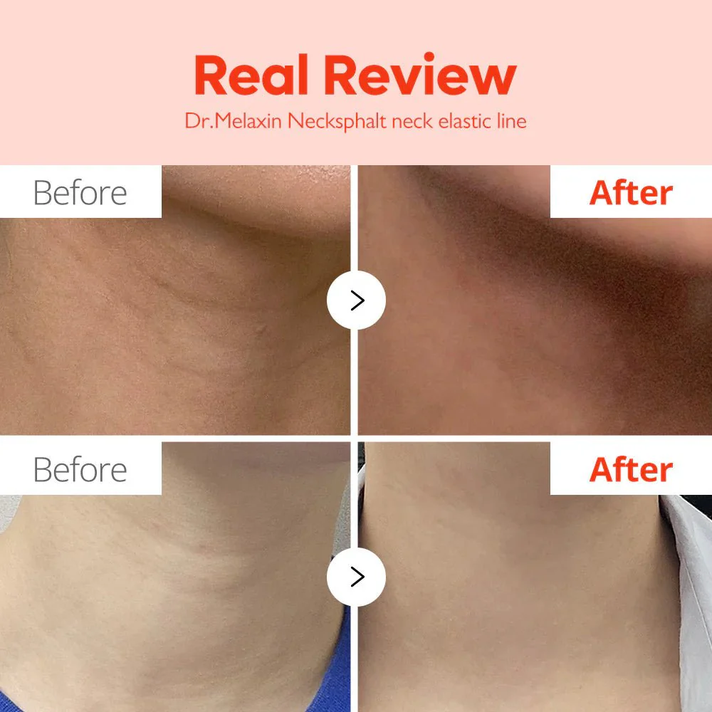 Dr.Melaxin Necklinephalt Neck Cream 20ml - Image 6