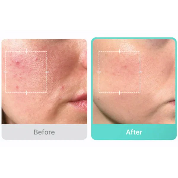 Medicube Calm Clear Glass Skin Routine - Image 6