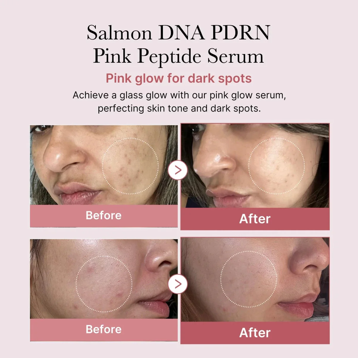 medicube PDRN Pink One Day Serum Set 1.5mlx10 - Image 7