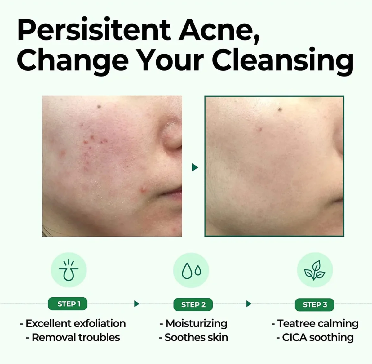 SOME BY MI AHA BHA PHA 30 Days Miracle Cleansing Bar 106g - Image 4