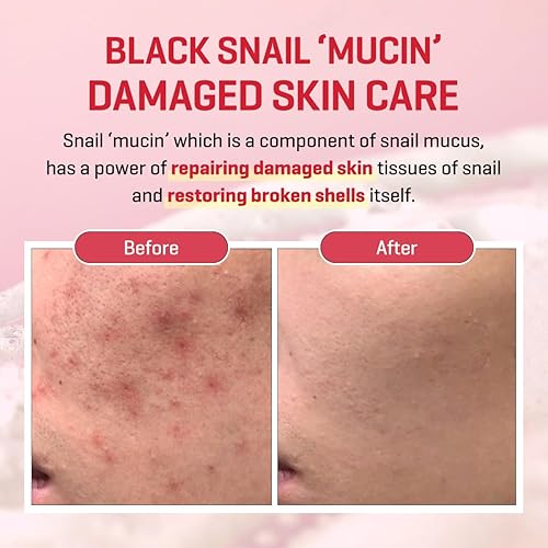 SOME BY MI Snail Truecica Miracle Cream 60g - Image 4