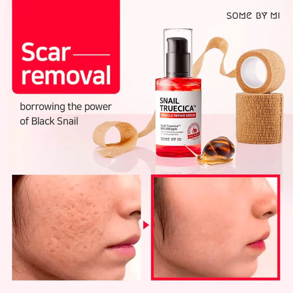 SOME BY MI Snail Truecica Miracle Skin Repair Set - Image 3