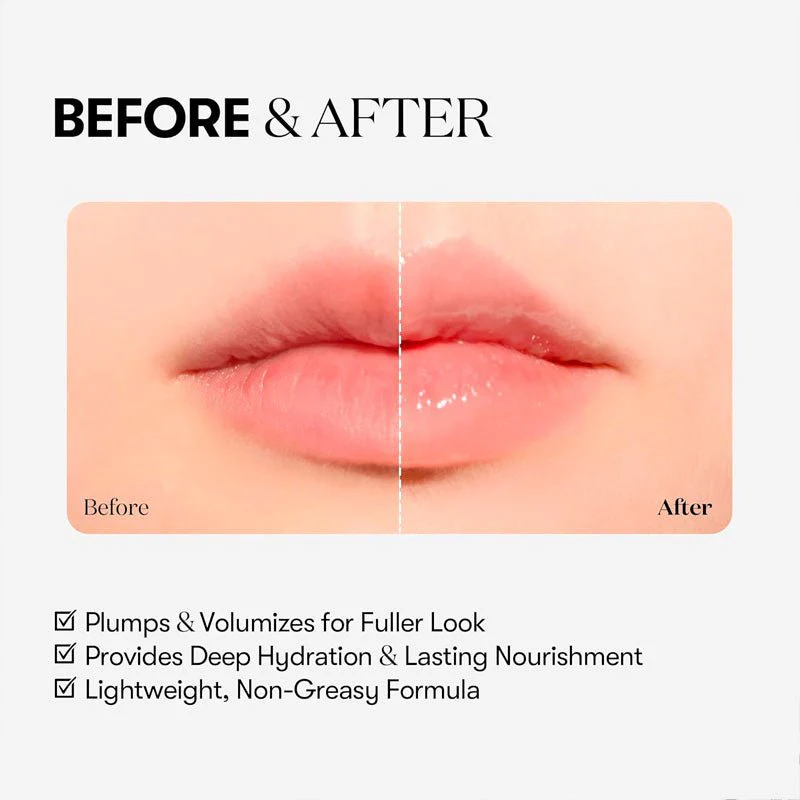 VT Reedle Shot Lip Plumper 4ml - Beginner - Image 4